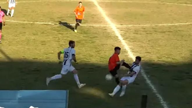 Player could lose a kidney after brutal kick