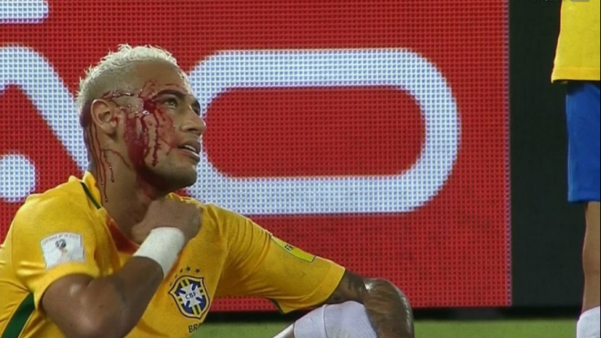 Neymar bloody